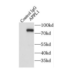 DCC-Interacting Protein 13-Alpha (APPL1) Antibody