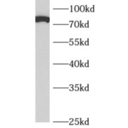 WB analysis of human brain tissue, using APPL1 antibody (1/500 dilution).