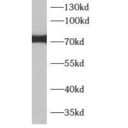 WB analysis of BxPC-3 cells, using APPL2 antibody (1/600 dilution).