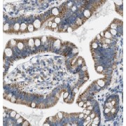 IHC-P analysis of human colon tissue, using ARAP3 Antibody (1/50 dilution).