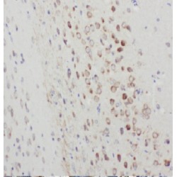 ARC / ARG3.1 Antibody