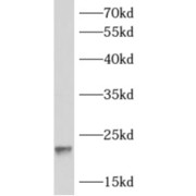 WB analysis of HeLa cells, using ARF1 antibody (1/500 dilution).