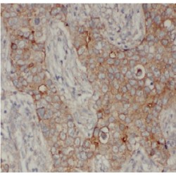 ADP-Ribosylation Factor 3 (ARF3) Antibody