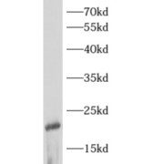 WB analysis of mouse brain tissue, using ARF3 antibody (1/800 dilution).