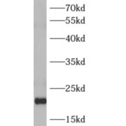 WB analysis of mouse brain tissue, using ARF4 antibody (1/800 dilution).