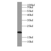 WB analysis of human liver tissue, using ARF6-Specific antibody (1/300 dilution).