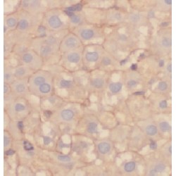 Arfaptin 2 (ARFIP2) Antibody