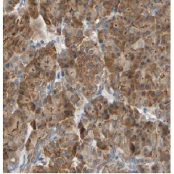 Rho GTPase-Activating Protein 1 (ARHGAP1) Antibody