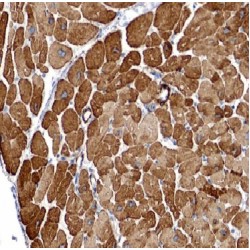 Rho GTPase-Activating Protein 10 (ARHGAP10) Antibody