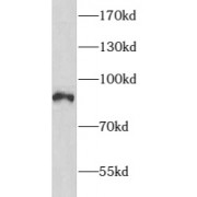 WB analysis of mouse heart tissue, using ARHGAP10 antibody (1/1000 dilution).