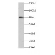 WB analysis of Jurkat cells, using ARHGAP25 antibody (1/1000 dilution).