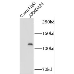 Rho GTPase Activating Protein 4 (ARHGAP4) Antibody