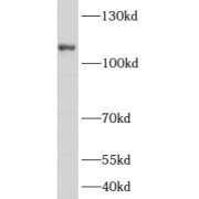 WB analysis of HL-60 cells, using ARHGAP4 antibody (1/1000 dilution).