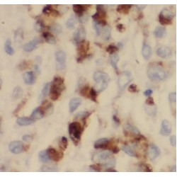 Rho GDP-Dissociation Inhibitor 2 (ARHGDIB) Antibody