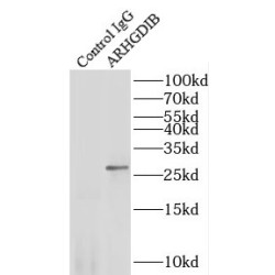 Rho GDP-Dissociation Inhibitor 2 (ARHGDIB) Antibody