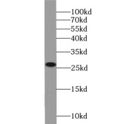 WB analysis of Jurkat cells, using ARHGDIB antibody (1/1000 dilution).