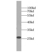 WB analysis of U-937 cells, using ARHGDIB antibody (1/1000 dilution).