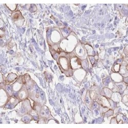 Rho Guanine Nucleotide Exchange Factor 18 (ARHGEF18) Antibody