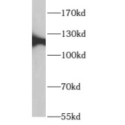 WB analysis of mouse testis tissue, using ARHGEF18 antibody (1/300 dilution).