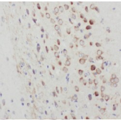 Rho Guanine Nucleotide Exchange Factor 4 (ARHGEF4) Antibody