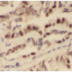 Rho Guanine Nucleotide Exchange Factor 5 (ARHGEF5) Antibody