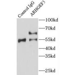 Rho Guanine Nucleotide Exchange Factor 5 (ARHGEF5) Antibody
