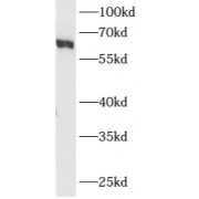 WB analysis of MCF7 cells, using ARHGEF5 antibody (1/500 dilution).