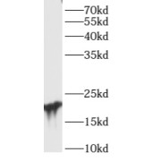 WB analysis of mouse thymus tissue, using ARL15 antibody (1/300 dilution).