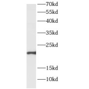 WB analysis of A549 cells, using ARL2BP antibody (1/300 dilution).