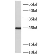 WB analysis of human liver tissue, using ARL5B antibody (1/500 dilution).