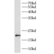 WB analysis of mouse brain tissue, using ARL8A antibody (1/600 dilution).