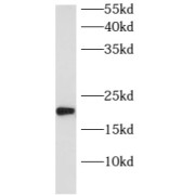 WB analysis of fetal human brain tissue, using ARL8B antibody (1/600 dilution).