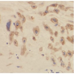 Armadillo Repeat Containing 10 (ARMC10) Antibody