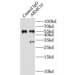 Armadillo Repeat Containing 10 (ARMC10) Antibody