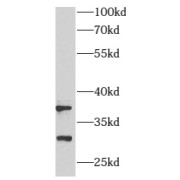 WB analysis of A431 cells, using ARMC10 antibody (1/500 dilution).