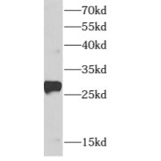 WB analysis of Transfected HEK-293 cells, using ARMC7 antibody (1/1000 dilution).