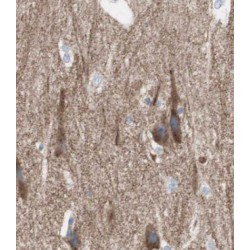 ARMET-Like Protein 1 (ARMETL1) Antibody