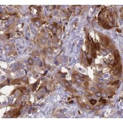 WB analysis of HeLa cells, using ARNTL antibody (1/600 dilution).