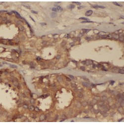 Actin Related Protein 2/3 Complex Subunit 2 (ARPC2) Antibody