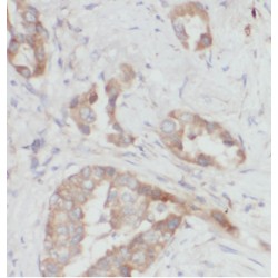 Actin Related Protein 2/3 Complex Subunit 4 (ARPC4) Antibody