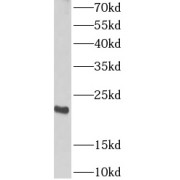 WB analysis of mouse brain tissue, using ARPC4 antibody (1/1000 dilution).