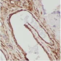 Actin-Related Protein 2/3 Complex Subunit 5-Like Protein (ARPC5L) Antibody