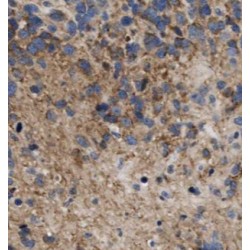 cAMP-Regulated Phosphoprotein 19 (ARPP-19) Antibody