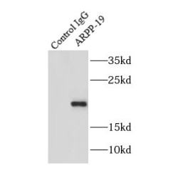 cAMP-Regulated Phosphoprotein 19 (ARPP-19) Antibody