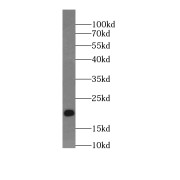 WB analysis of Jurkat cells, using ARPP-19 antibody (1/500 dilution).