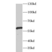 WB analysis of mouse testis tissue, using ARSA antibody (1/1000 dilution).