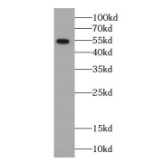 WB analysis of HeLa cells, using ARSK-Specific antibody (1/300 dilution).