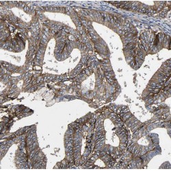 Endoplasmic Reticulum Aminopeptidase 1 (ARTS1) Antibody