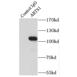 Endoplasmic Reticulum Aminopeptidase 1 (ARTS1) Antibody