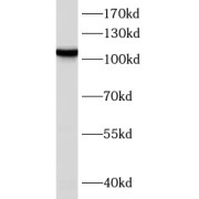 WB analysis of Jurkat cells, using ERAP1 antibody (1/1000 dilution).